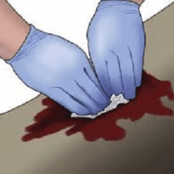 Hemostasis y Shock Hipovolemico.